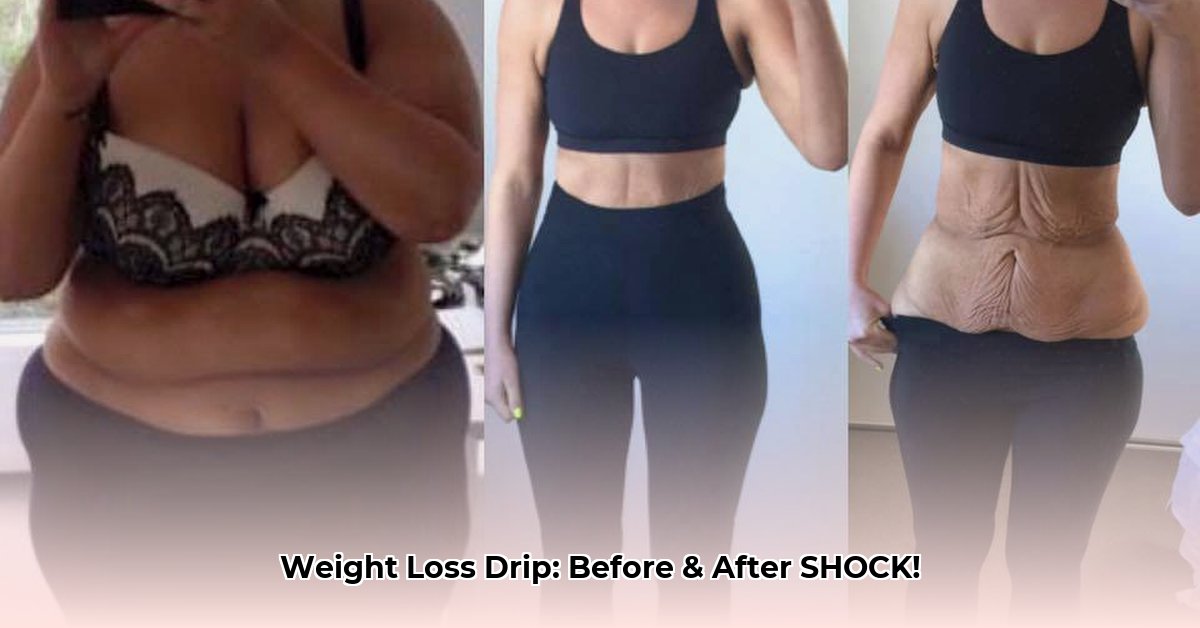 weight-loss-drip-before-and-after